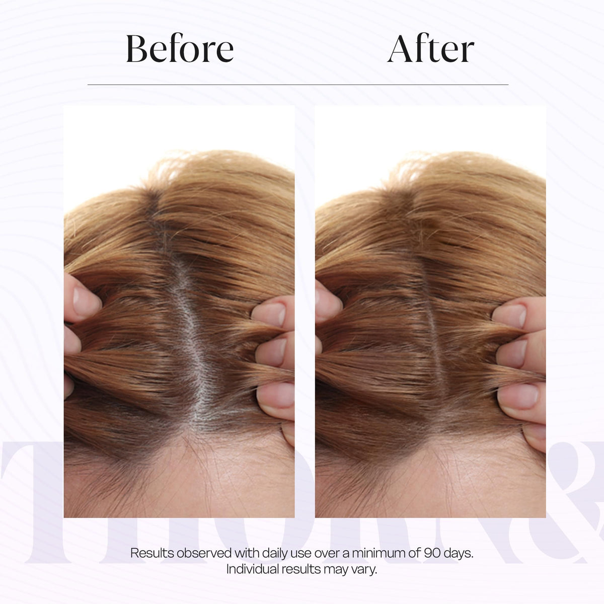 THORN & BERRY applying serum to scalp demonstrating targeted use benefit