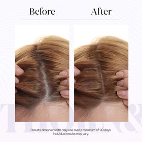THORN & BERRY applying serum to scalp demonstrating targeted use benefit