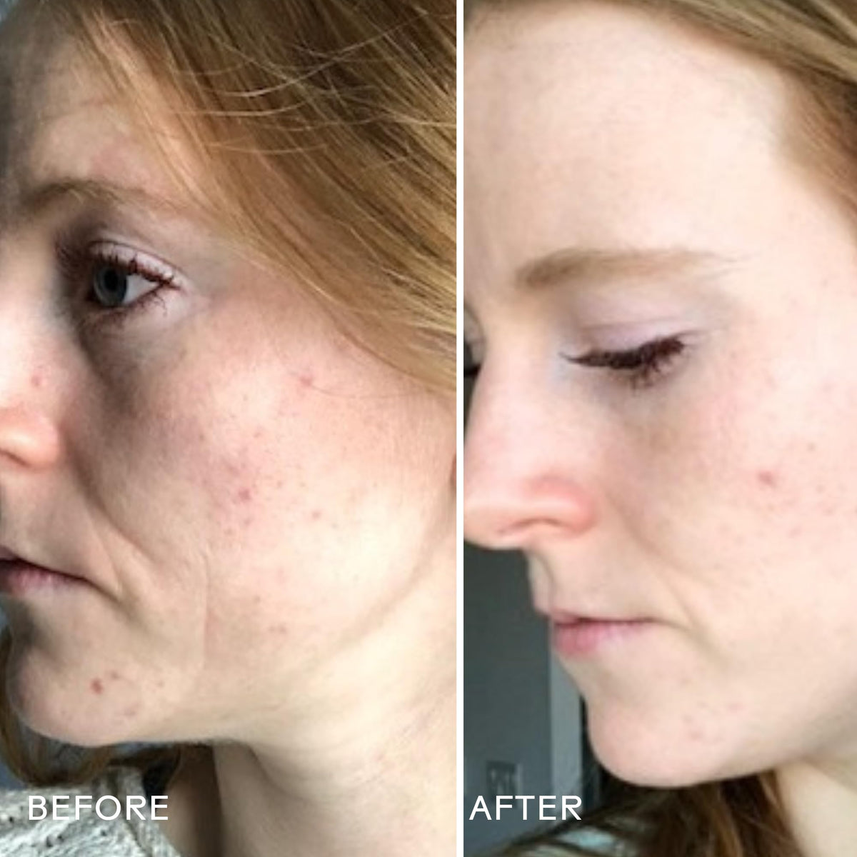 Three Ships papaya extract close-up highlighting natural enzymes for brighter skin