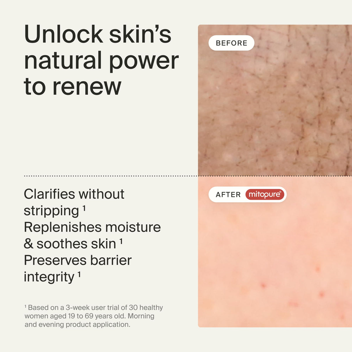 Close-up of Timeline cream-to-mousse texture highlighting soft moisturizing feel