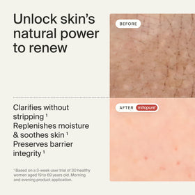 Close-up of Timeline cream-to-mousse texture highlighting soft moisturizing feel