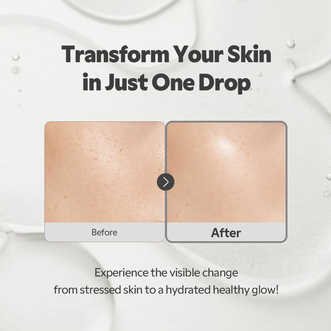 TIRTIR SOS Serum held in hand to show size, useful for travel and routine planning