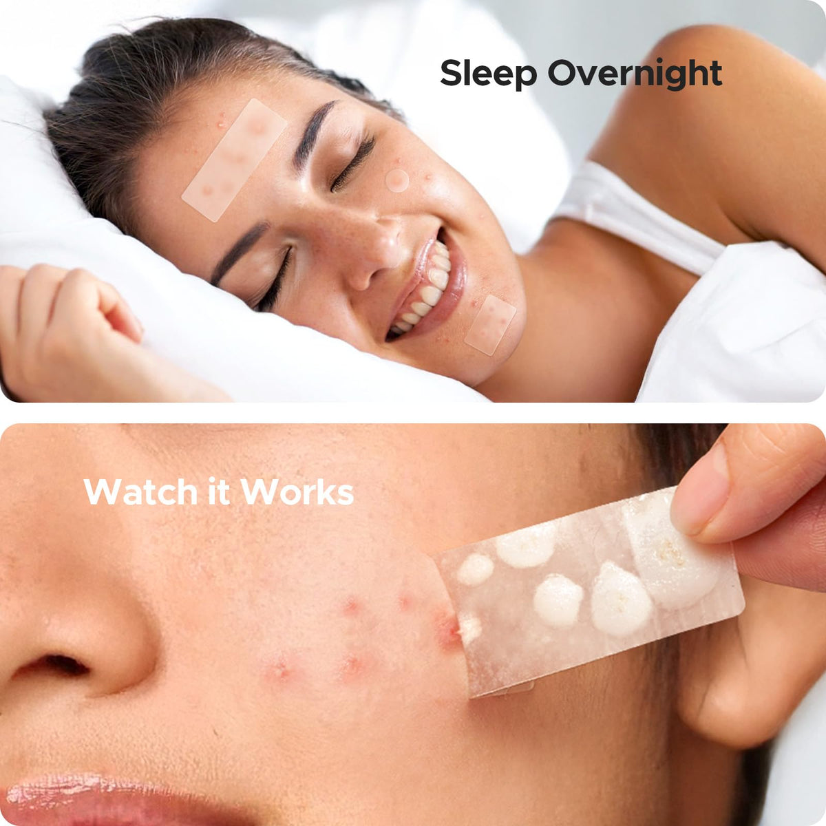 TKTK application on cheek showing patch placement and hands-off healing support