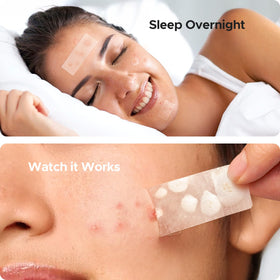 TKTK application on cheek showing patch placement and hands-off healing support