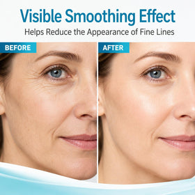 TKYT application under eye demonstrating targeted lifting and smoothing benefit