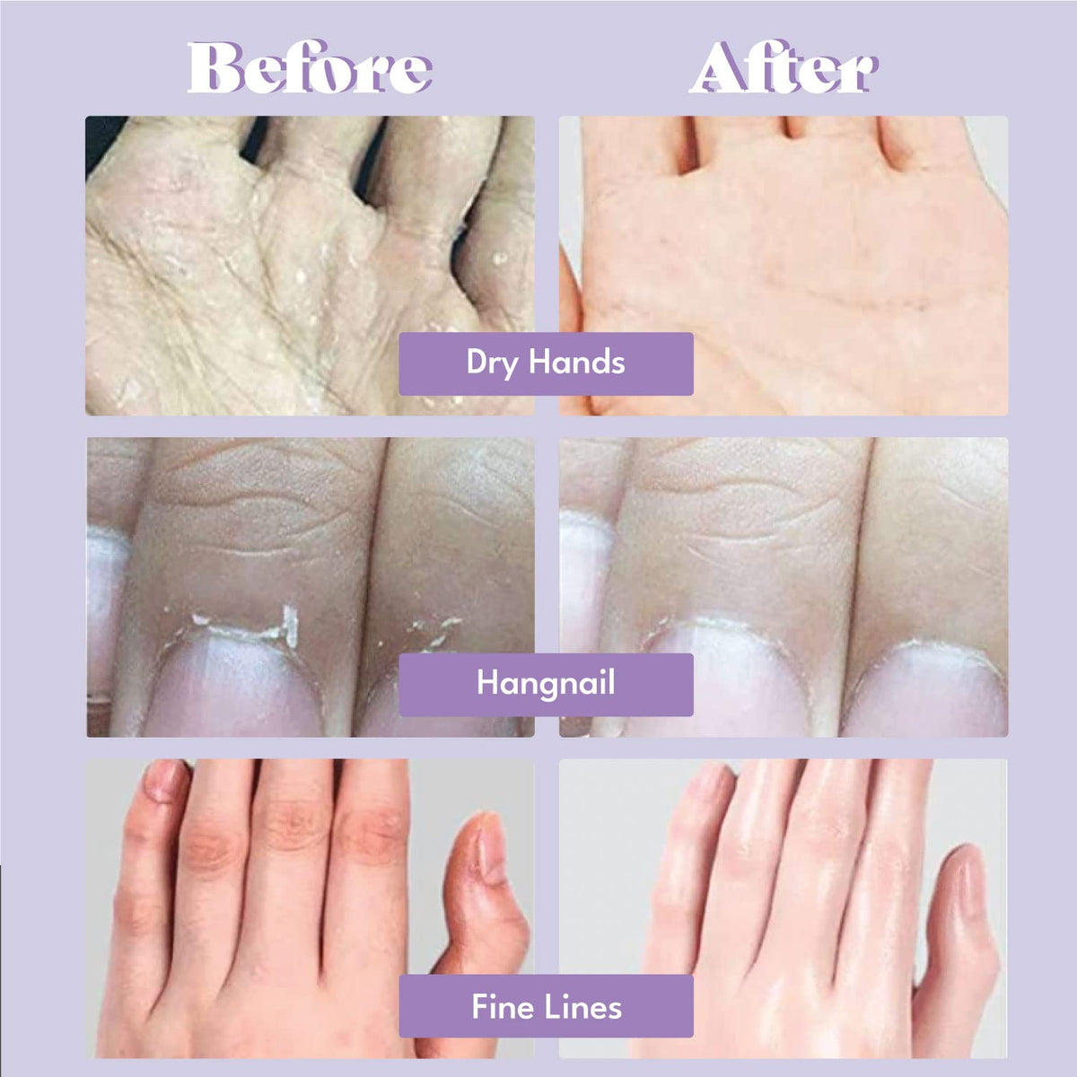 TOI:L hand mask in use on a woman demonstrating comfortable fit