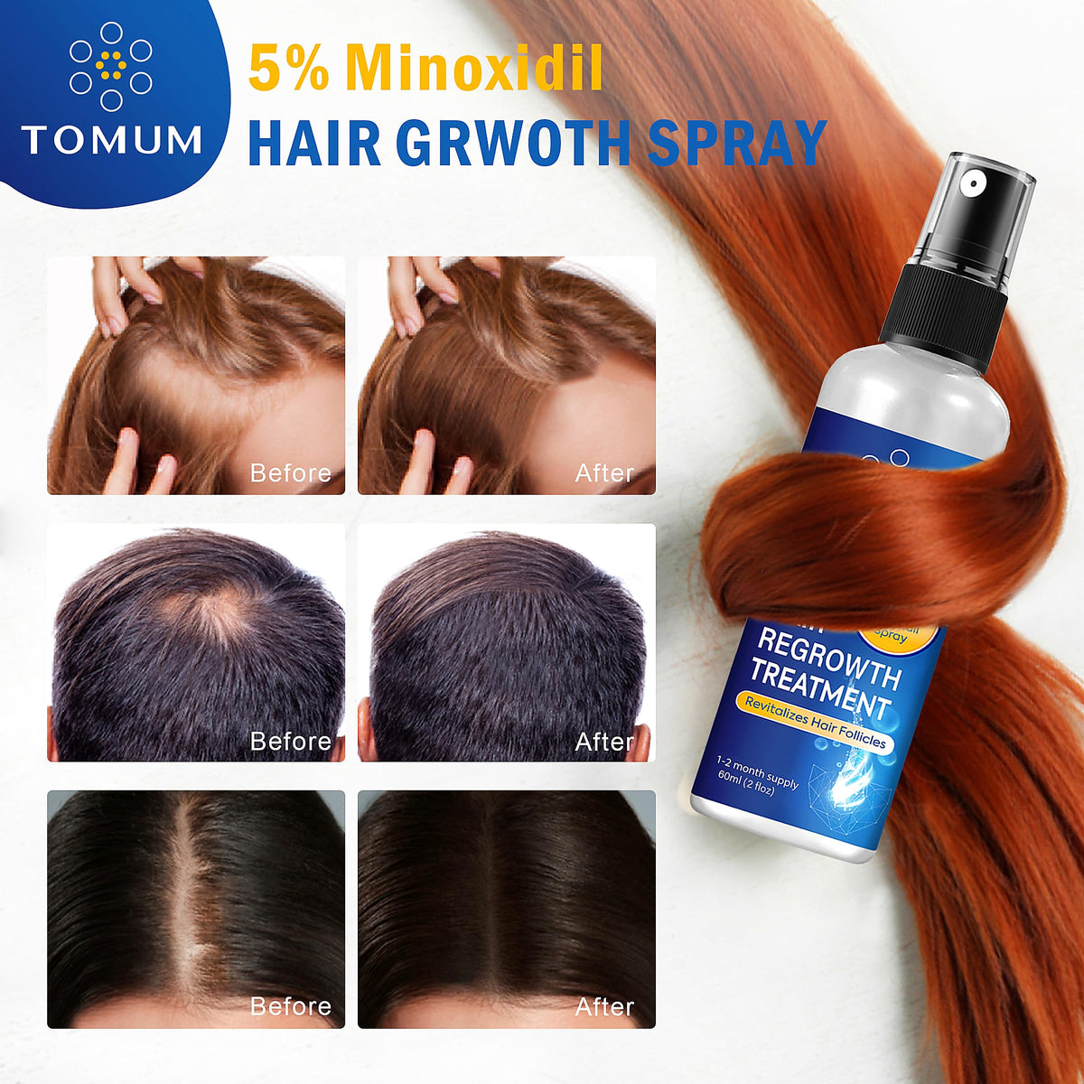 TOMUM two-pack boxed set staged to show supply and value for ongoing treatment