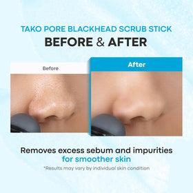 TONYMOLY ingredients label highlighting charcoal, marine extracts, and tea tree for skin balance benefit