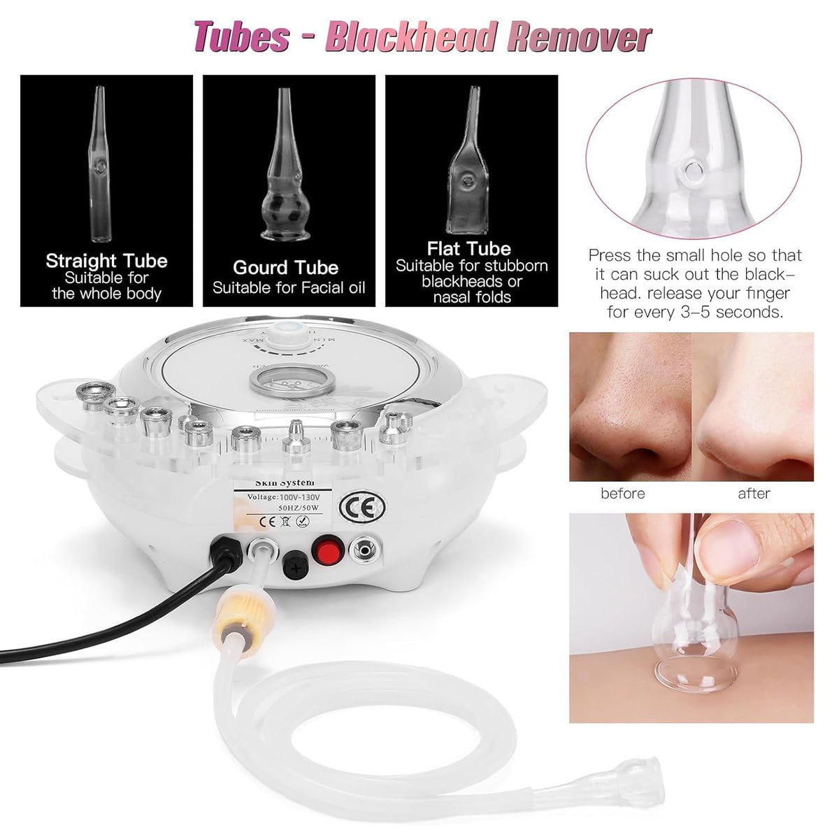 TopDirect vacuum port detail highlighting suction nozzle for efficient pore extraction