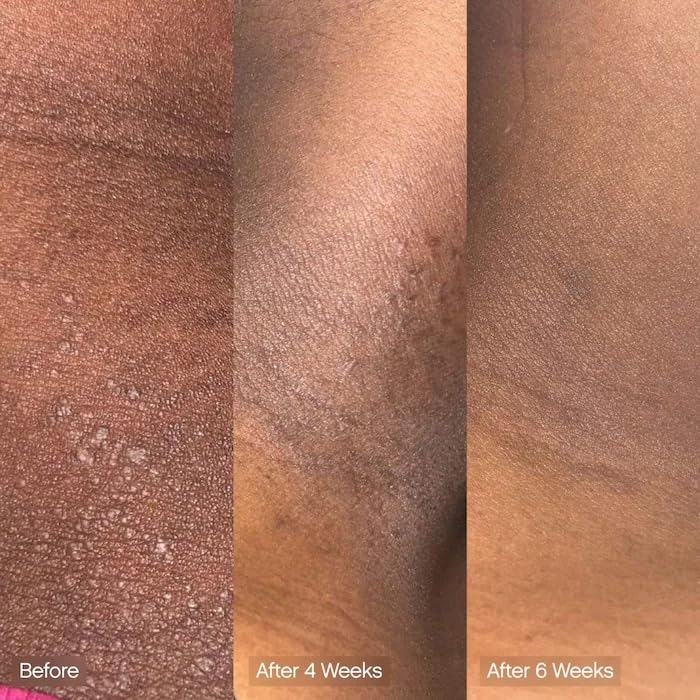 Topicals cleansing bar in use on body showing moisturizing skin-softening effect