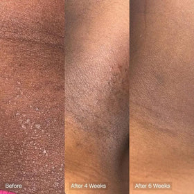 Topicals cleansing bar in use on body showing moisturizing skin-softening effect