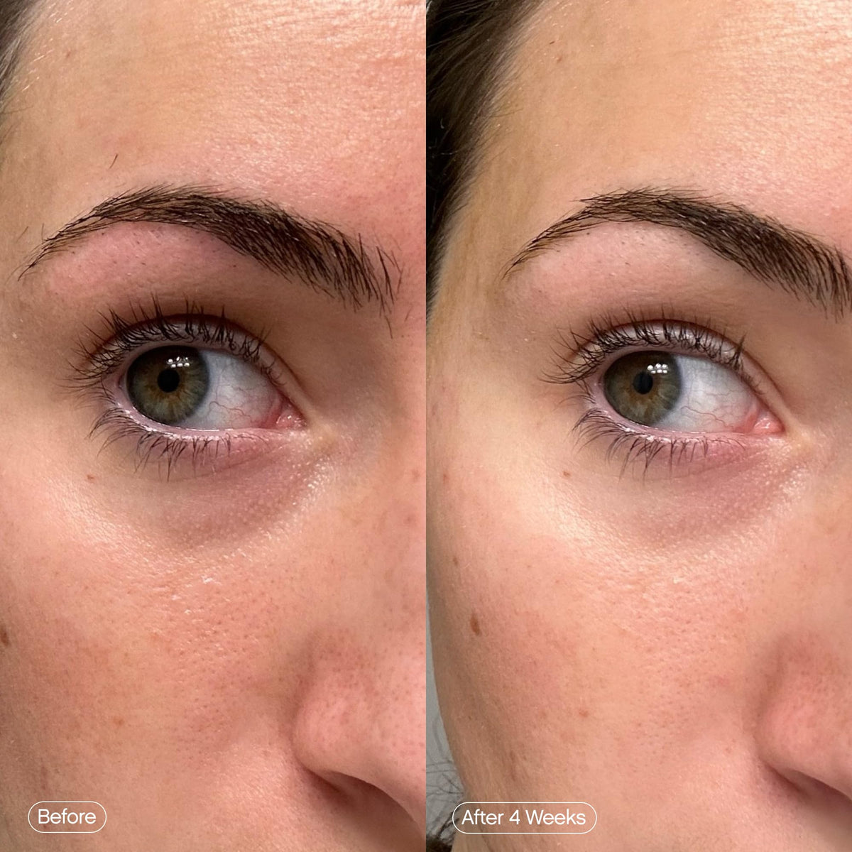 Topicals ingredient arrangement with kojic, niacinamide and caffeine benefit clarity