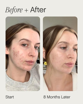 Topicals serum texture close-up showing lightweight consistency and fast absorption benefit