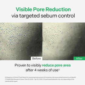 Torriden before and after skin finish showing reduced shine and smoother texture
