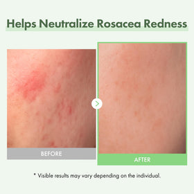 TOSOWOONG serum drop applied on hand demonstrating smooth spread and quick absorption