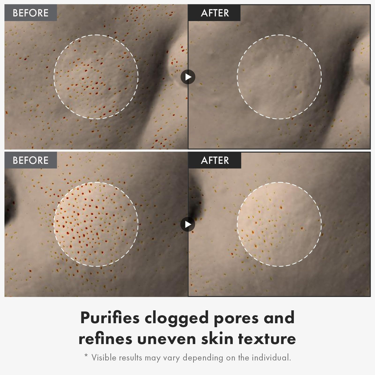 TOSOWOONG texture drop on fingertip demonstrating lightweight hydrating gel