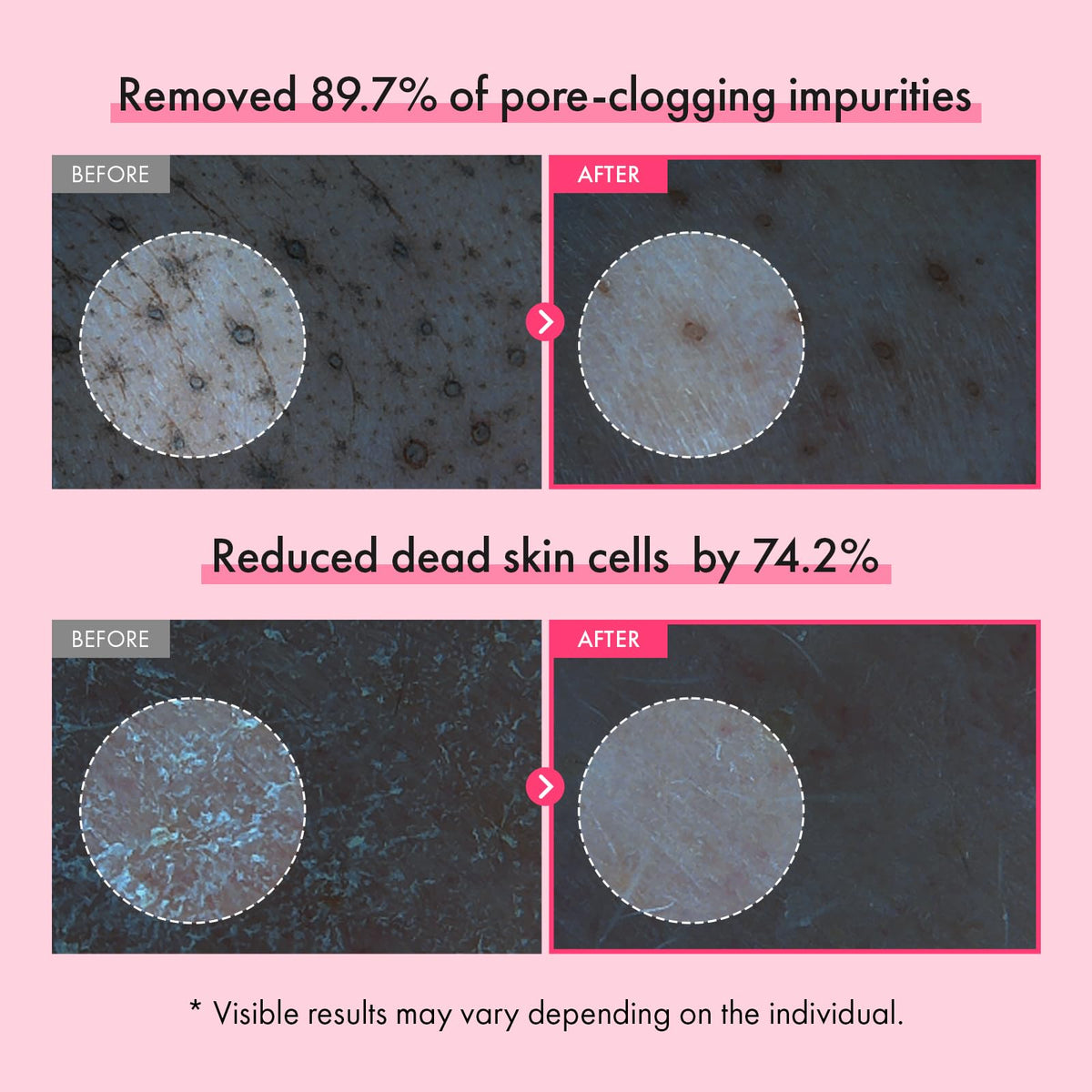 TOSOWOONG pink capsules on foam releasing active ingredients into pores