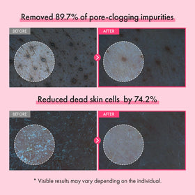 TOSOWOONG pink capsules on foam releasing active ingredients into pores
