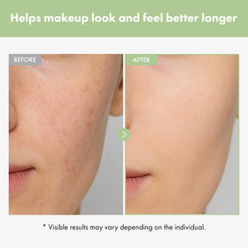 TOSOWOONG product next to ruler showing 20ml travel‑friendly size