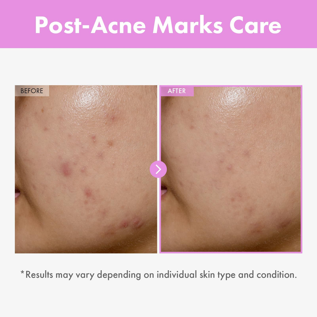TOSOWOONG close-up label showing peptide complex, communicates targeted skin support