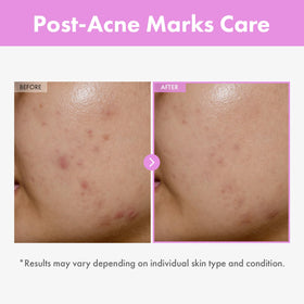 TOSOWOONG close-up label showing peptide complex, communicates targeted skin support