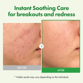TOSOWOONG cream applied on hand demonstrating quick absorption benefit