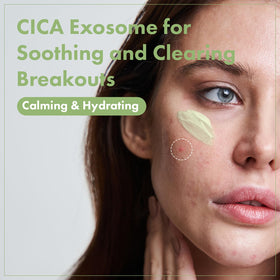 TOSOWOONG cream texture close-up highlighting lightweight hydration