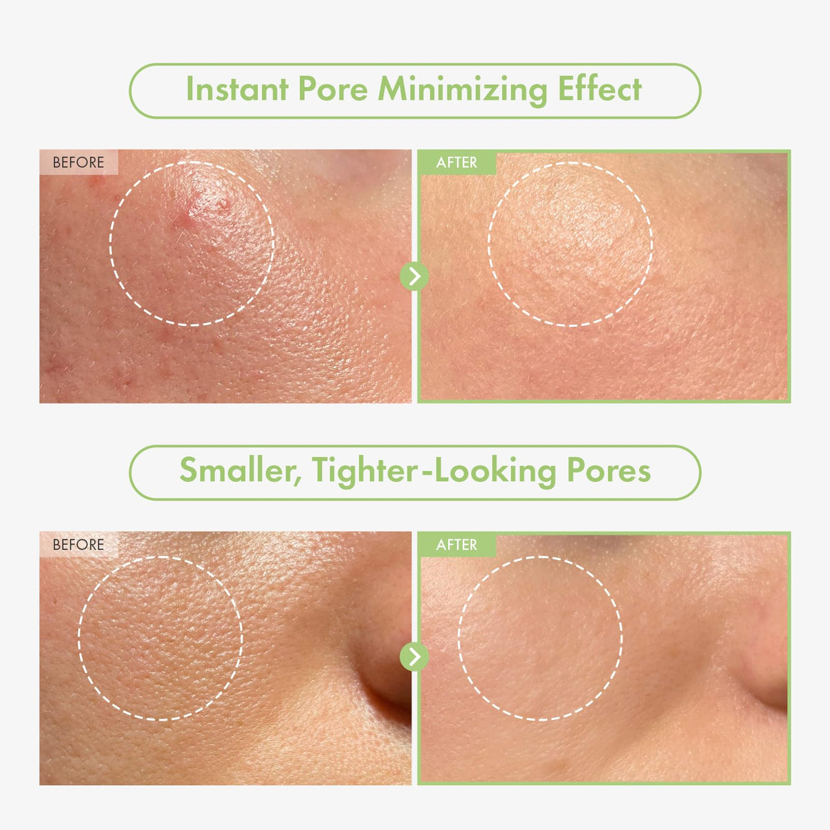 TOSOWOONG ampoule pipette dispensing serum for precise, no-waste application