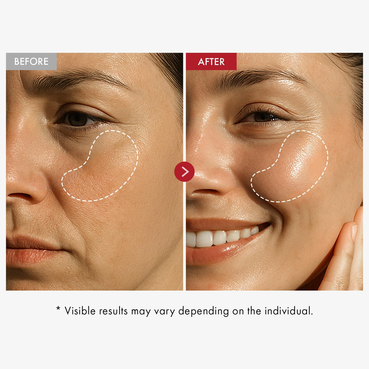 TOSOWOONG collagen water and ingredient concept emphasizing concentrated formulation benefit