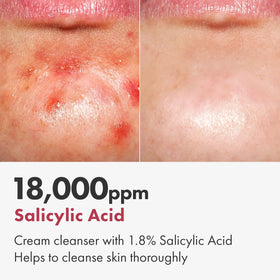 TOSOWOONG label with centella and aloe highlights to indicate soothing botanicals