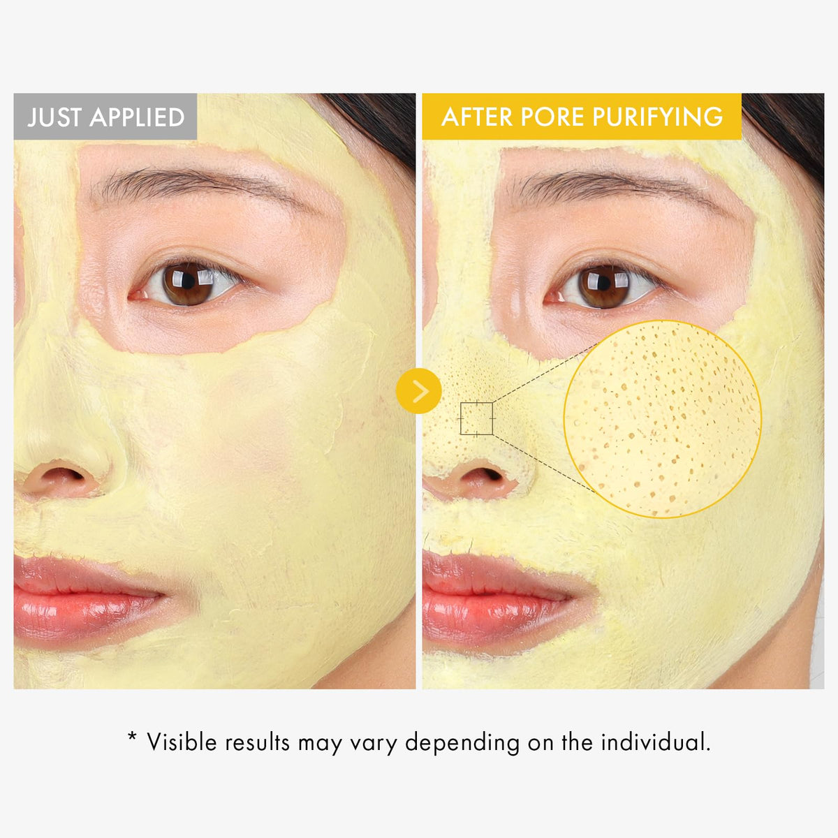TOSOWOONG mask applied on cheek demonstrating quick cooling effect
