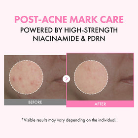 TOSOWOONG close-up of milky texture delivering lightweight moisture