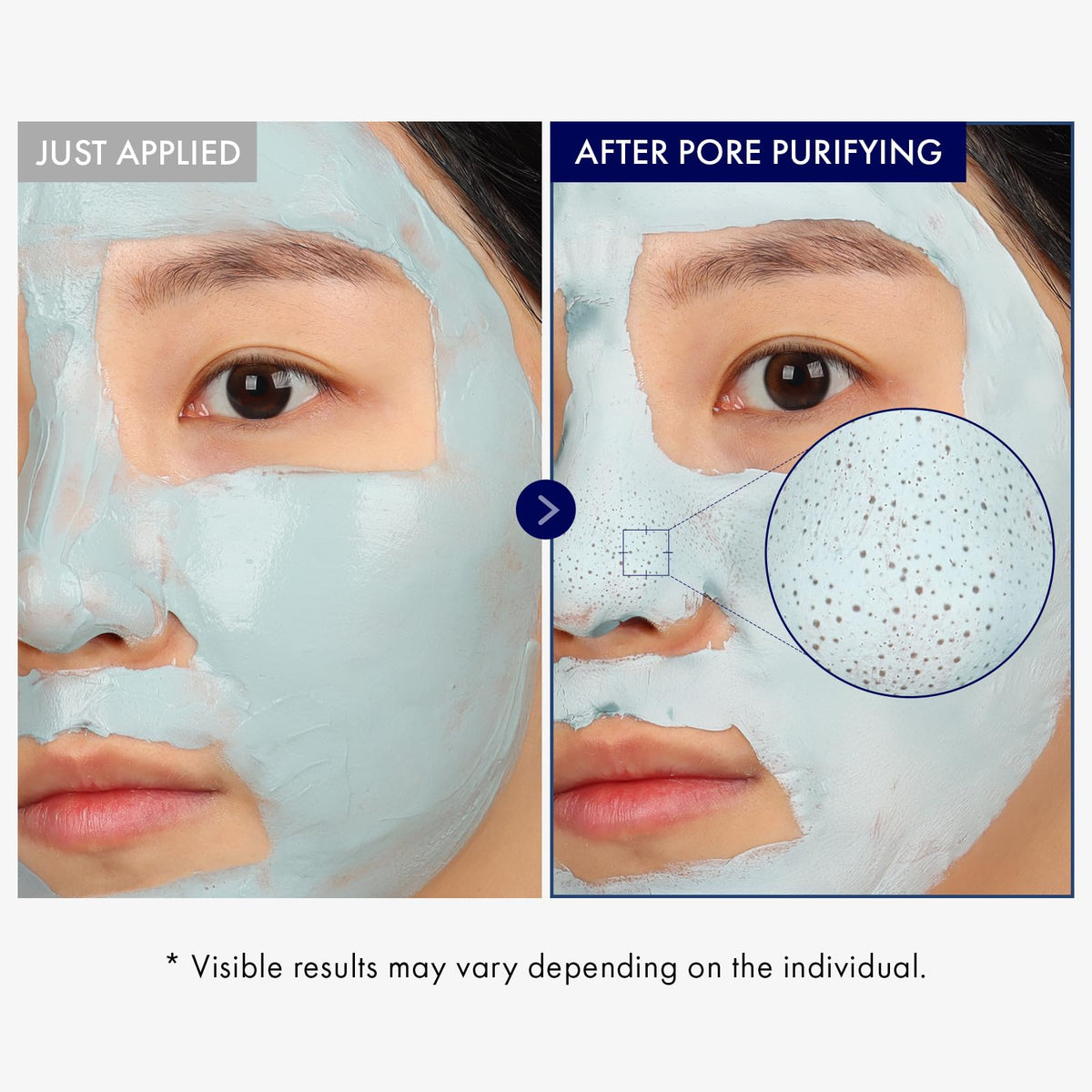 TOSOWOONG applied to nose area demonstrating pore-targeted use