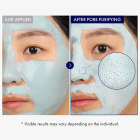 TOSOWOONG applied to nose area demonstrating pore-targeted use