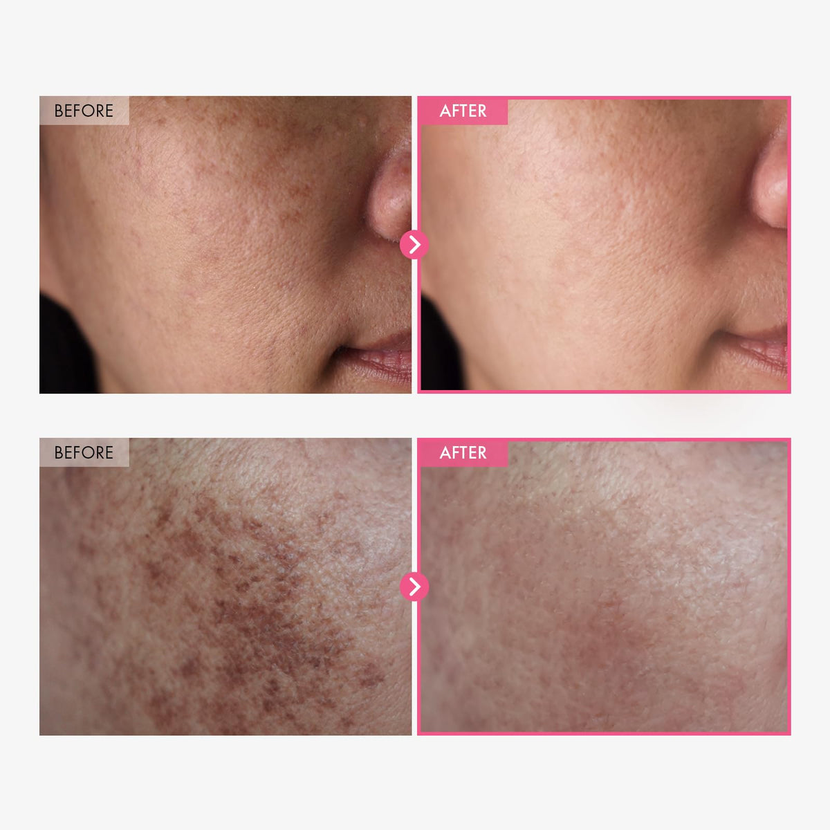 TOSOWOONG cream texture close-up highlighting lightweight absorption