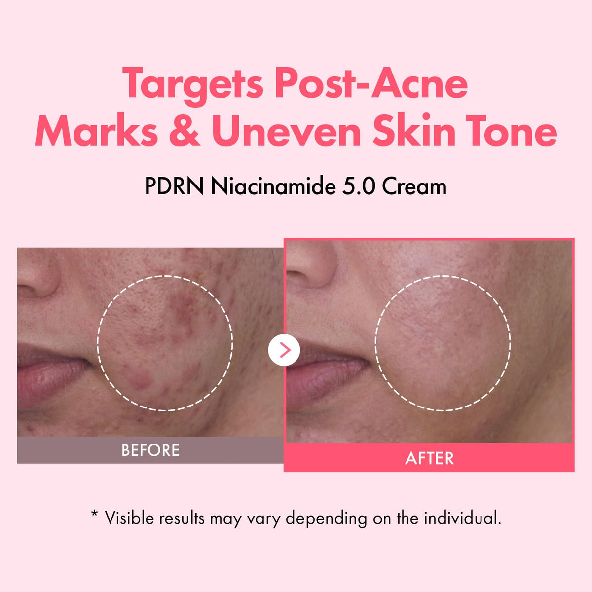 TOSOWOONG open jar texture revealing light pink cream, moisturizing fast absorption