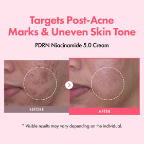 TOSOWOONG open jar texture revealing light pink cream, moisturizing fast absorption