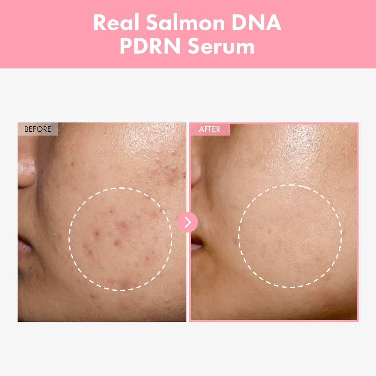TOSOWOONG serum texture close-up drop showing lightweight hydration