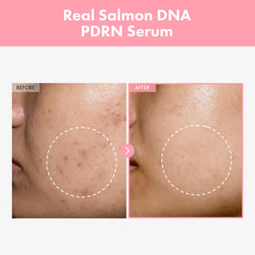 TOSOWOONG serum texture close-up drop showing lightweight hydration