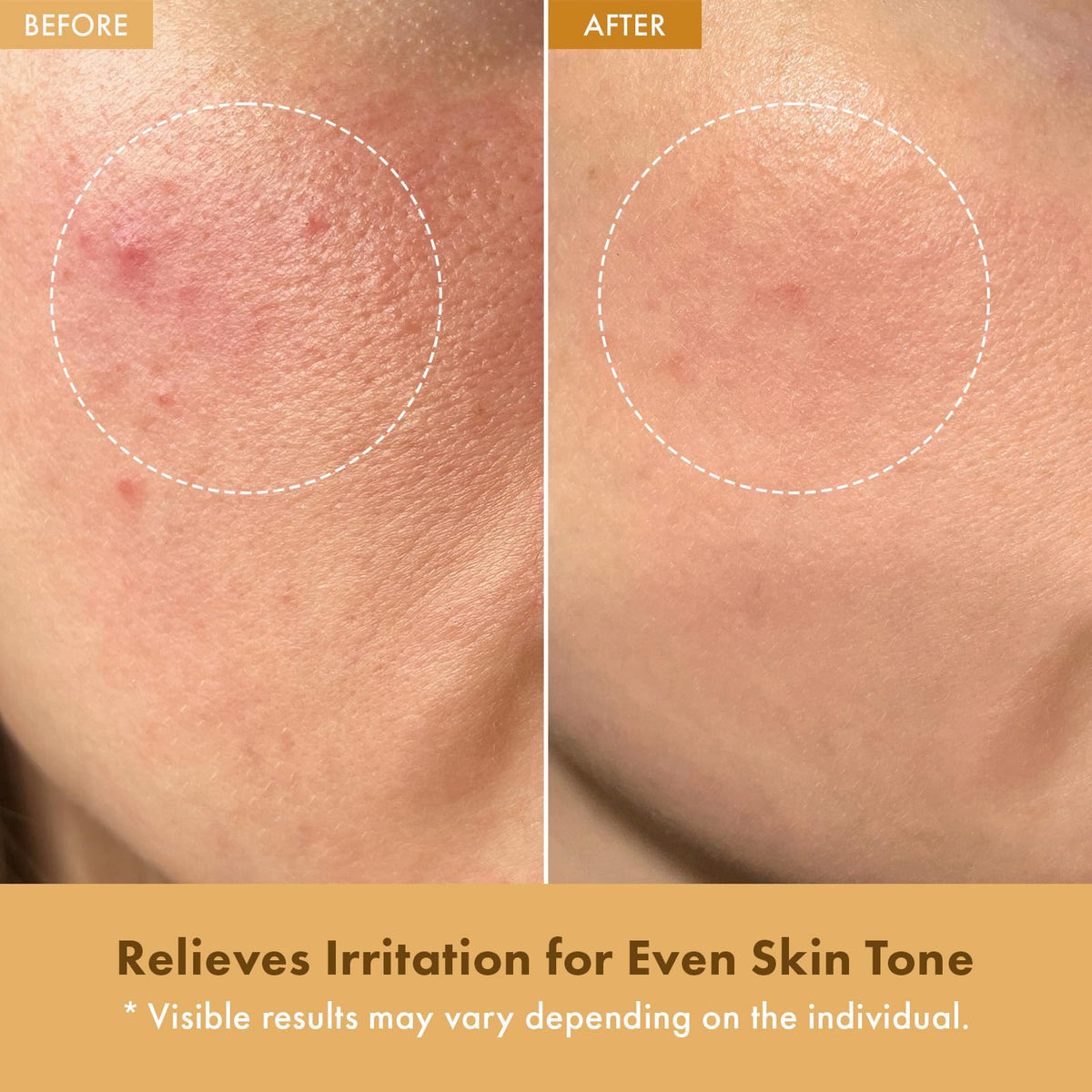 TOSOWOONG cream texture close-up demonstrating lightweight, fast-absorbing hydration