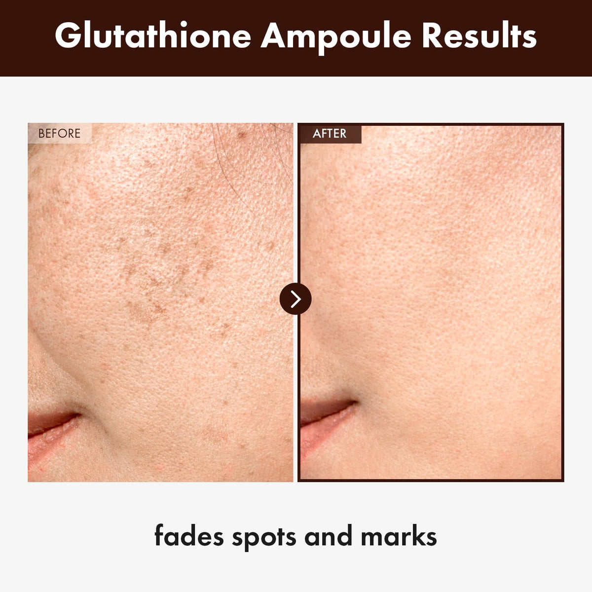 TOSOWOONG dropper dispensing serum illustrating easy controlled application benefit