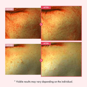 TOSOWOONG pump dispensing serum demonstrating easy application and controlled dosage