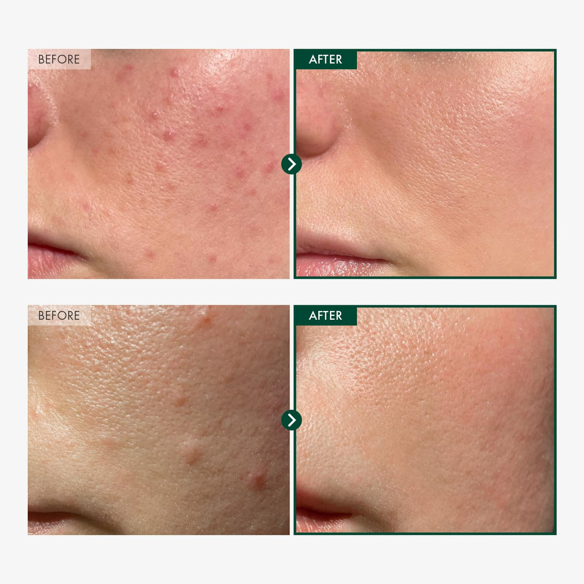 TOSOWOONG serum texture close-up highlighting smooth absorption