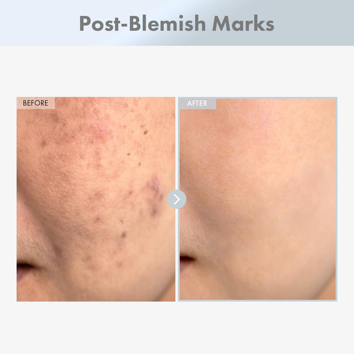 TOSOWOONG serum texture close-up showing lightweight finish for fast absorption