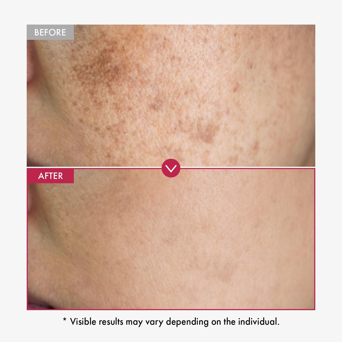 TOSOWOONG serum texture close-up on skin, highlighting fast absorption and hydrating finish