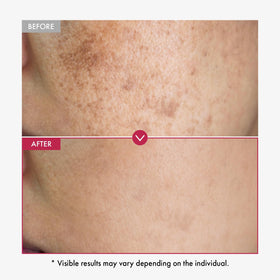 TOSOWOONG serum texture close-up on skin, highlighting fast absorption and hydrating finish