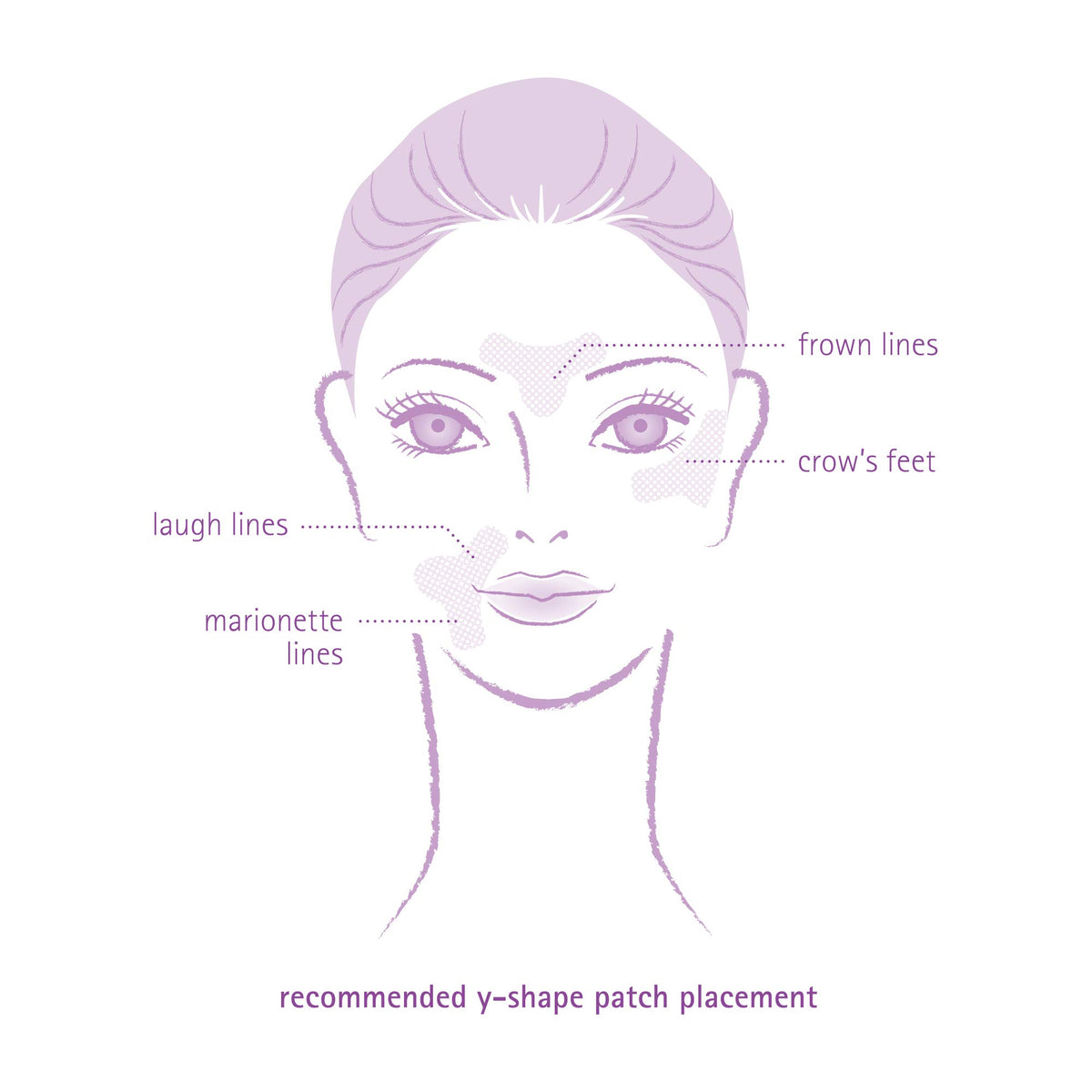 Toute Nuit patch applied on forehead demonstrating line‑reducing immobilization