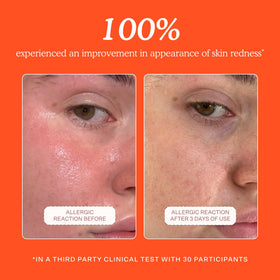 Tower 28 close texture droplet on skin showing lightweight absorbency benefit