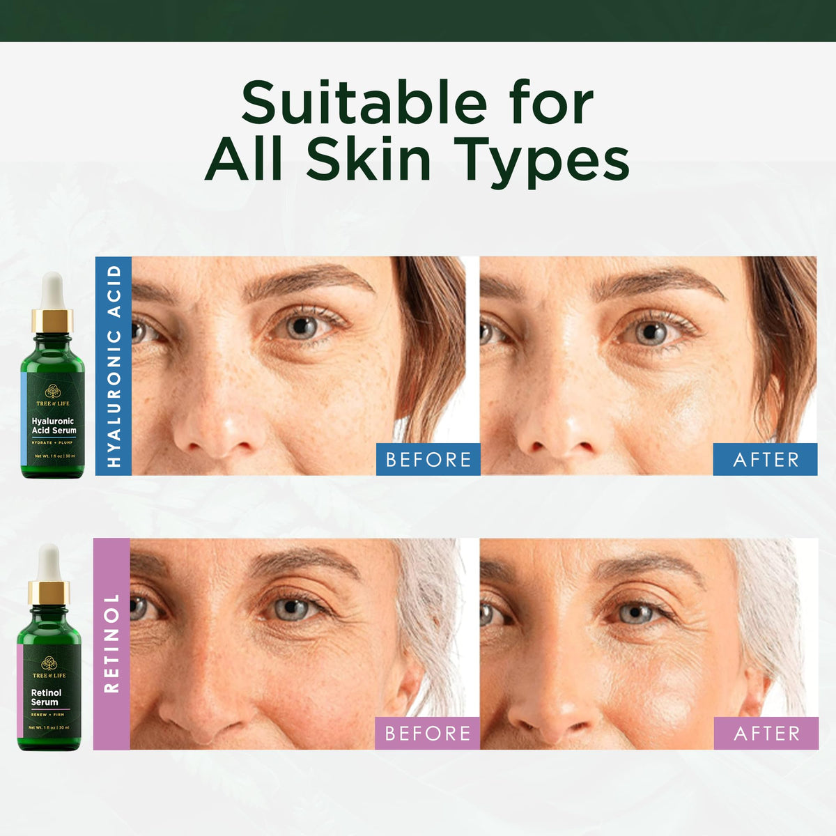 Tree of Life Beauty label close-up showing dermatologist-tested and cruelty-free