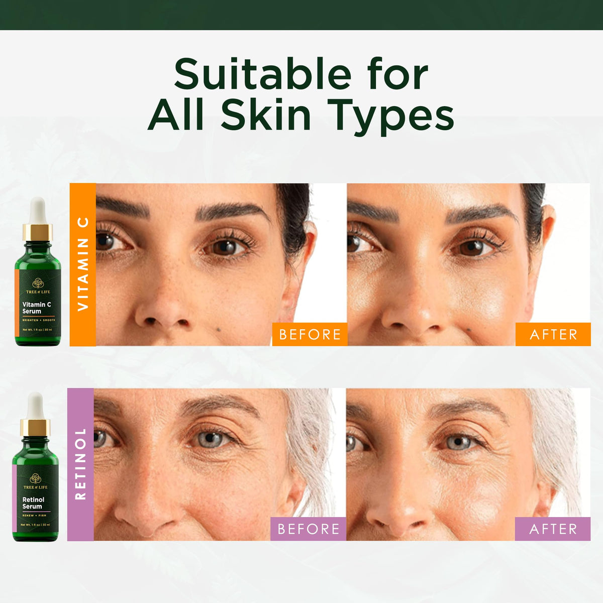 Tree of Life Beauty hyaluronic acid droplet on skin showing hydration and plumping